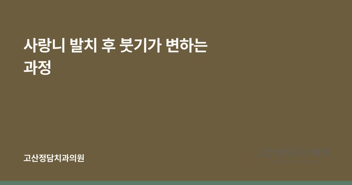 사랑니 발치 후 붓기가 변하는 과정
