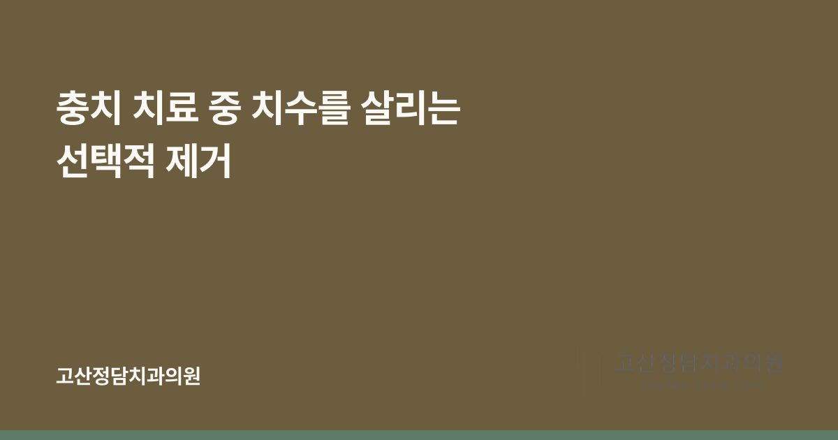 충치 치료 중 치수를 살리는 선택적 제거