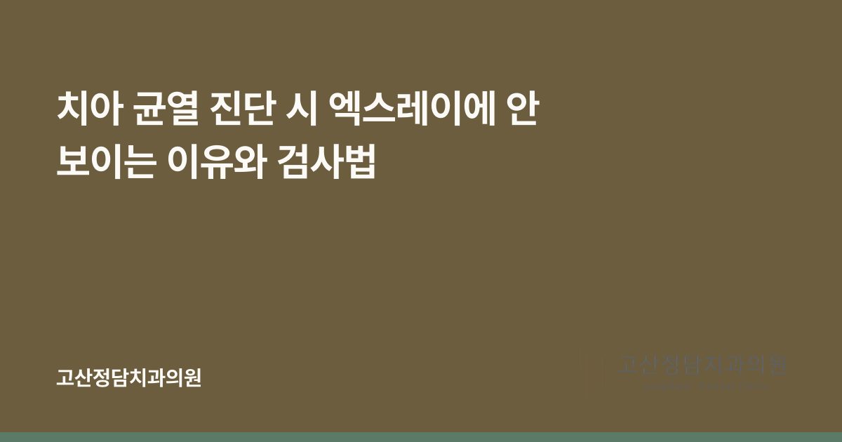 치아 균열 진단 시 엑스레이에 안 보이는 이유와 검사법