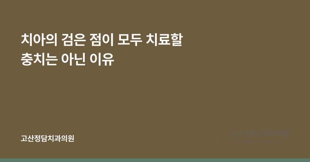 치아의 검은 점이 모두 치료할 충치는 아닌 이유