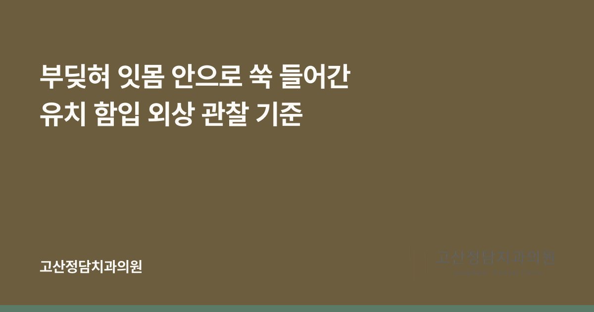 부딪혀 잇몸 안으로 쑥 들어간 유치 함입 외상 관찰 기준
