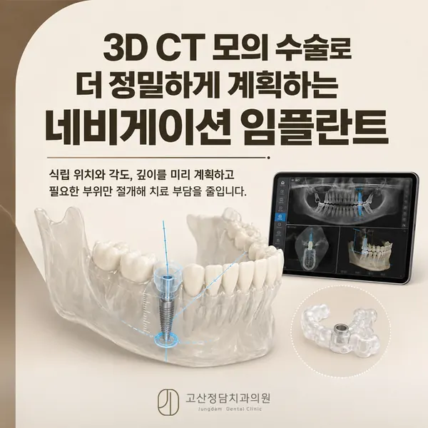 의정부치과 임플란트, 잇몸뼈 정밀 진단부터 사후관리까지 알아야 할 것들