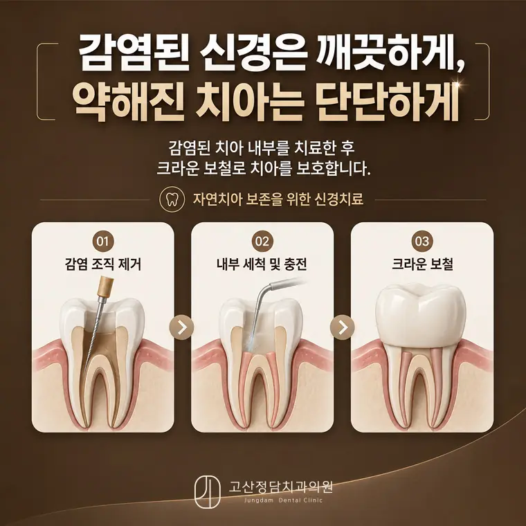 의정부치과 충치·잇몸치료, 자연치아를 지키는 진료가 중요한 이유