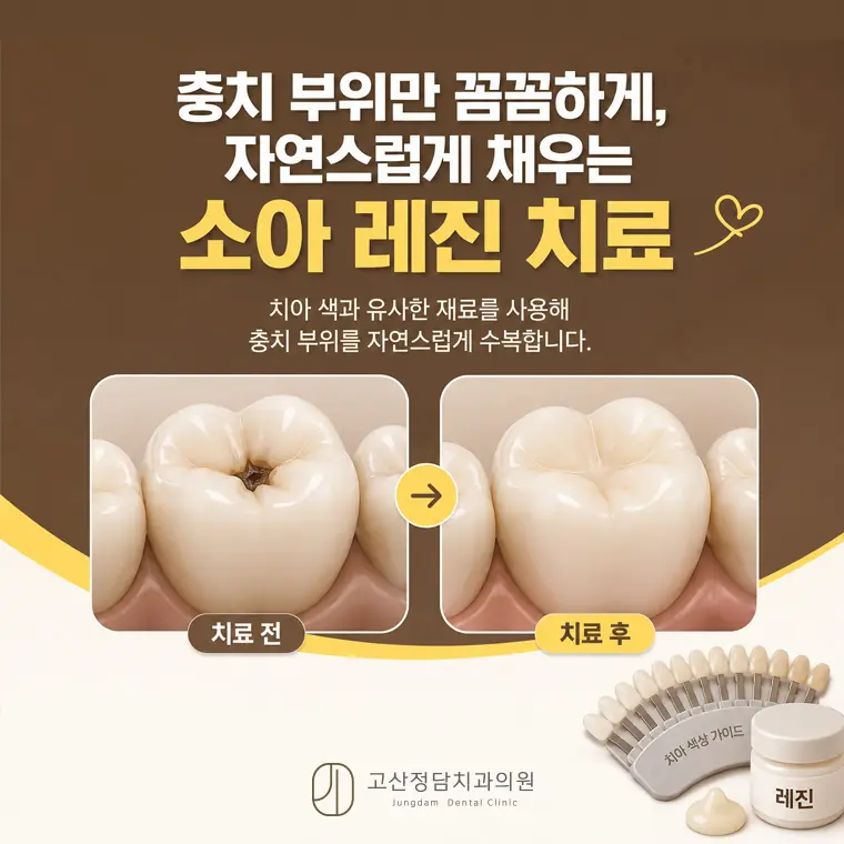 영유아 구강검진 4차례 시기, 불소도포·실란트 예방 시술, 소아 진정치료까지 사실에 기반해 설명합니다.