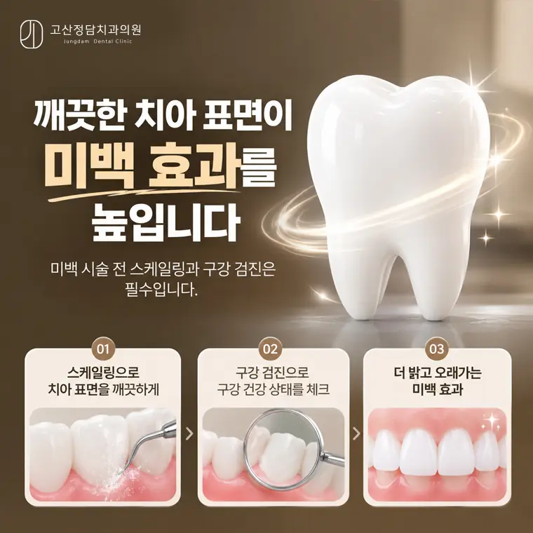 의정부치과, 고산동치과, 의정부치아미백, 전문가치아미백, 치아착색, 치과스케일링