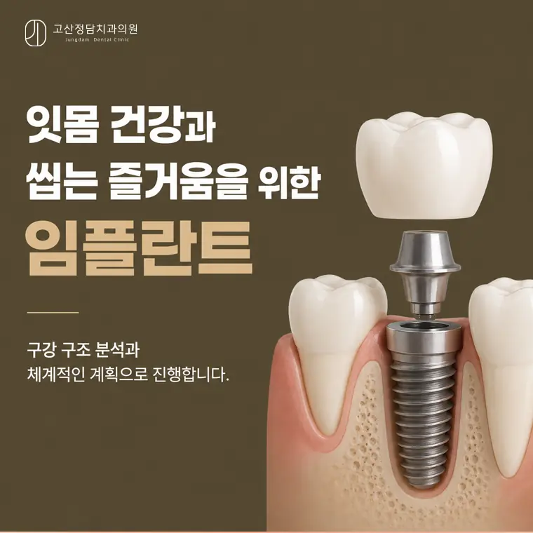 의정부치과 임플란트, 잇몸뼈 정밀 진단부터 사후관리까지 알아야 할 것들