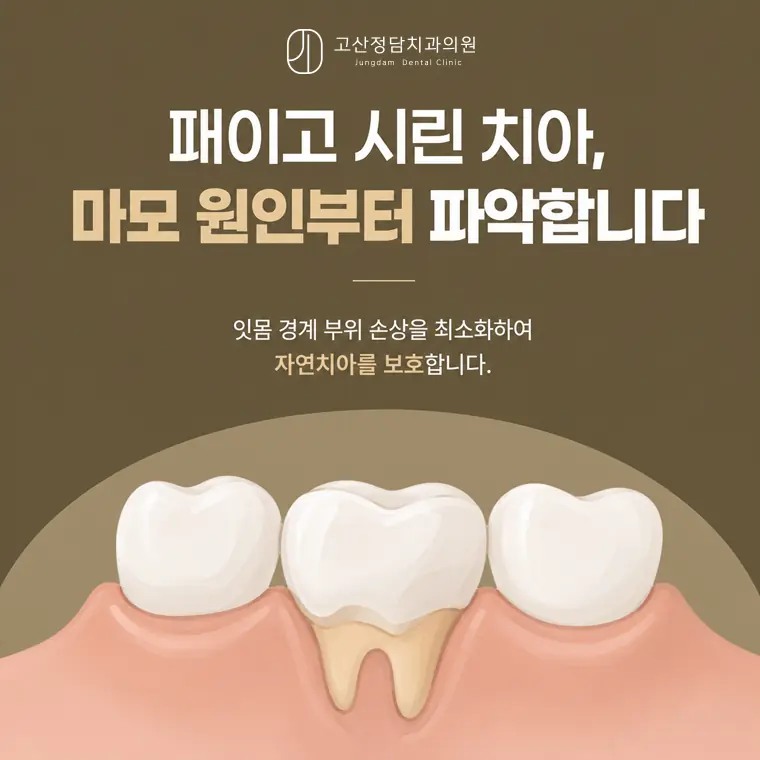 의정부치과, 고산동치과, 의정부임플란트, 네비게이션 임플란트, 디지털 임플란트, 임플란트 치료기간, 임플란트 비용