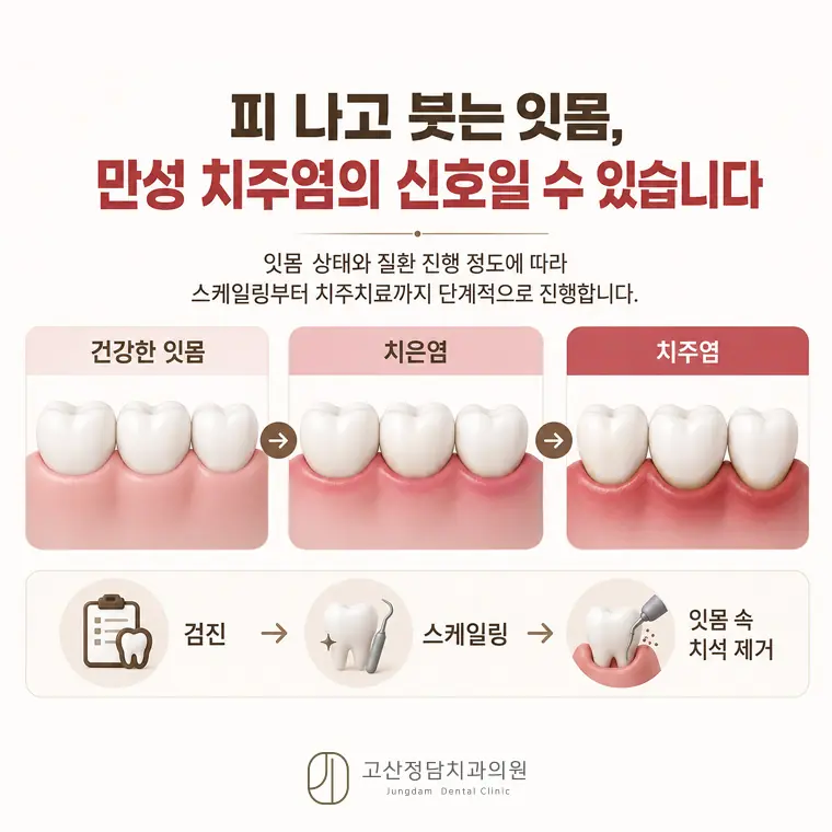 자연치아 보존을 우선하는 진료 방향과 정기적인 스케일링 관리의 필요성을 사실에 기반해 설명합니다.