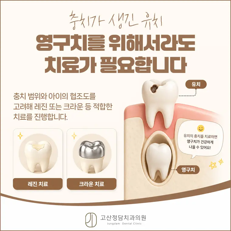 의정부치과 고산정담치과의원이 안내하는 소아 구강 관리 정보입니다.