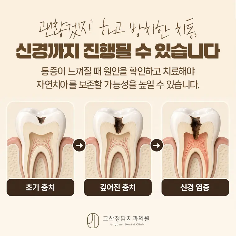 의정부치과 고산정담치과의원이 안내하는 충치치료와 잇몸치료 정보입니다.