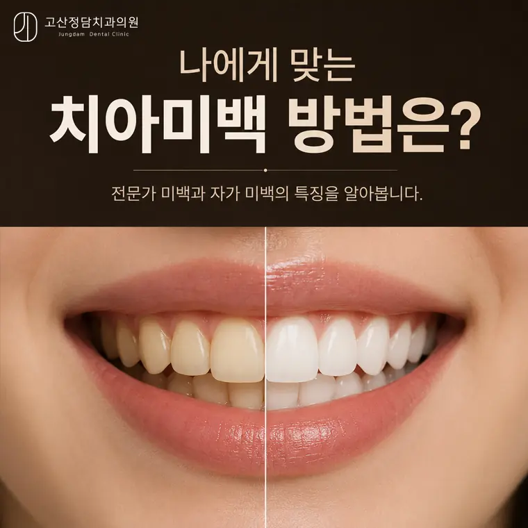 의정부치과 고산동 전문가 치아미백 원리와 시술 과정 안내